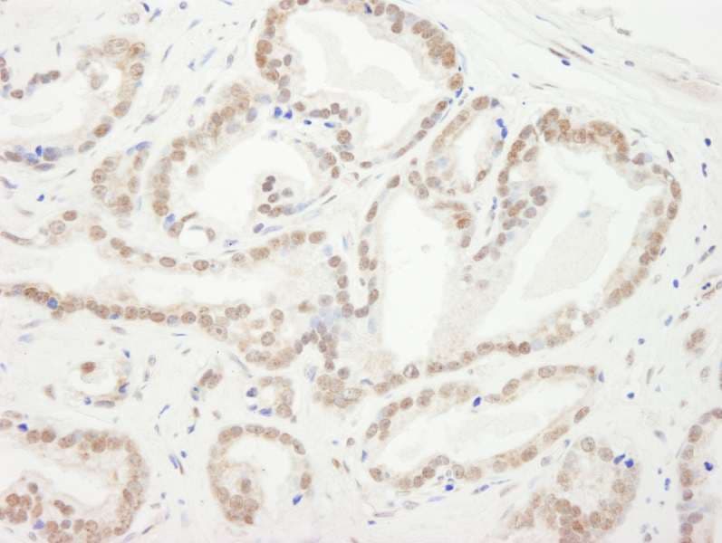 Polyclonal Rabbit anti-Human CBX5 / HP1 Alpha Antibody (aa150-C-term, IHC, WB)