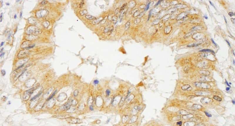 Polyclonal Rabbit anti-Human GRB10 Antibody (aa100-150, IHC)