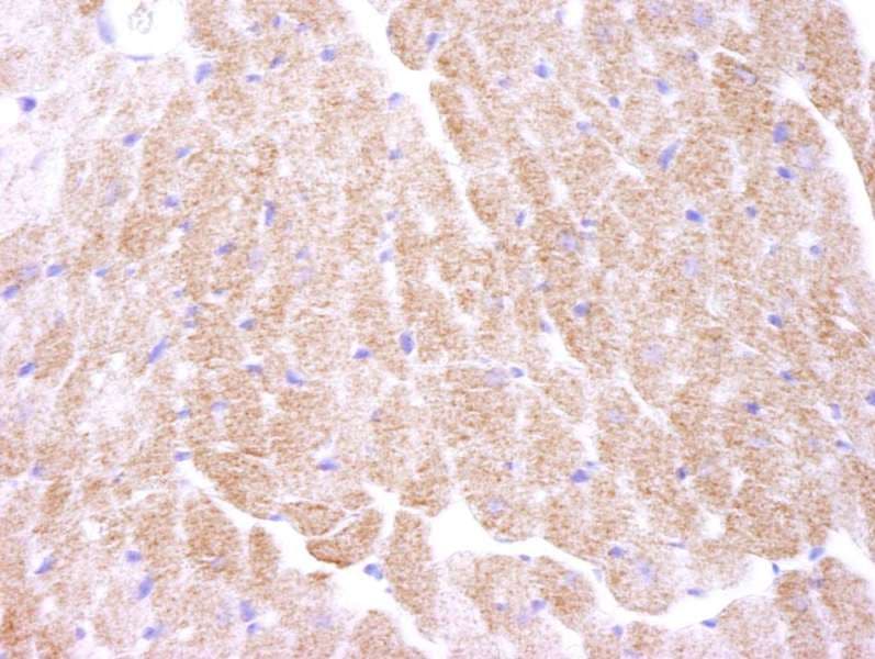 Polyclonal Rabbit anti-Human PRKAA1 / AMPK Alpha 1 Antibody (aa350-400, IHC)
