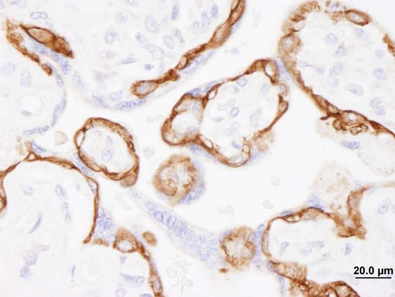 Polyclonal Rabbit anti-Human EGFR Antibody (aa1150-C-term, IHC, IF)