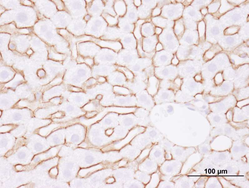 Polyclonal Rabbit anti-Human EGFR Antibody (aa1150-C-term, IHC, IF)
