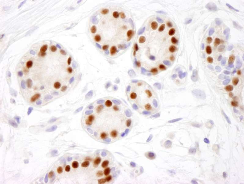 ER Alpha / Estrogen Receptor Antibody (aa550-C-term)