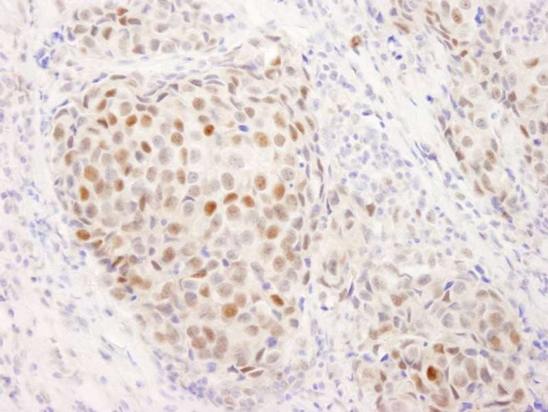 ER Alpha / Estrogen Receptor Antibody (aa550-C-term)