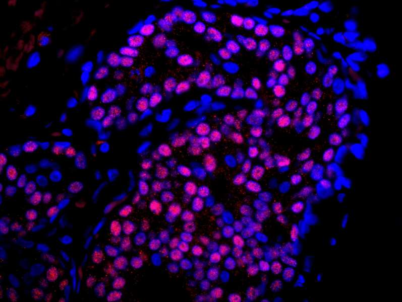 ER Alpha / Estrogen Receptor Antibody (aa550-C-term)