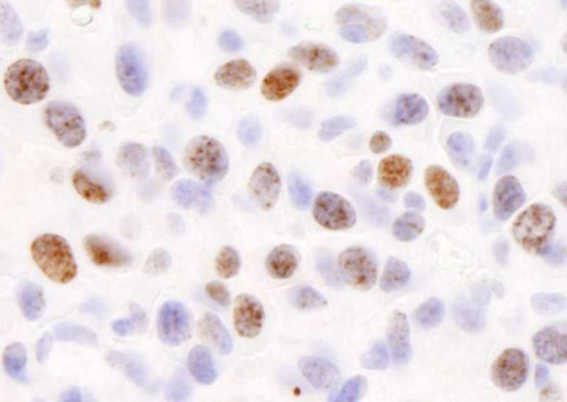 H2AFX / H2AX Antibody (C-Terminus)