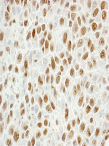 PCNA Antibody (aa225-C-term)