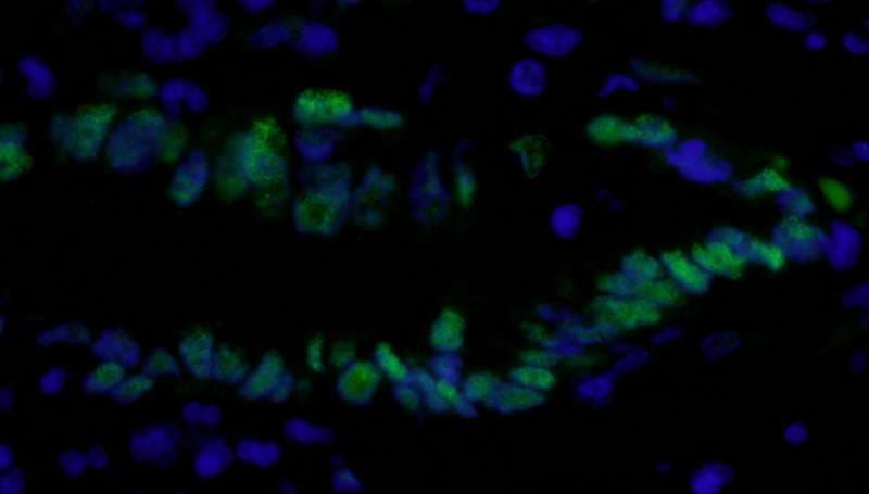 PCNA Antibody (aa225-C-term)