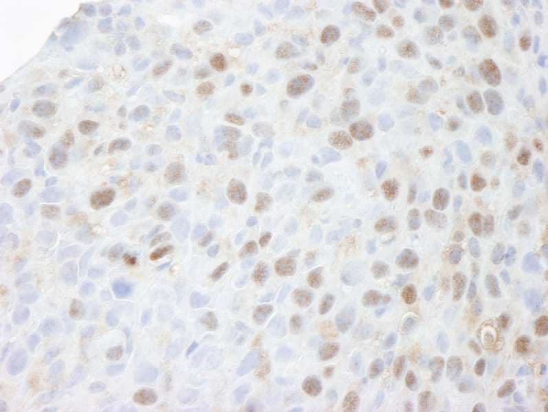 Polyclonal Rabbit anti-Human MCM3 Antibody (aa500-550, IHC)