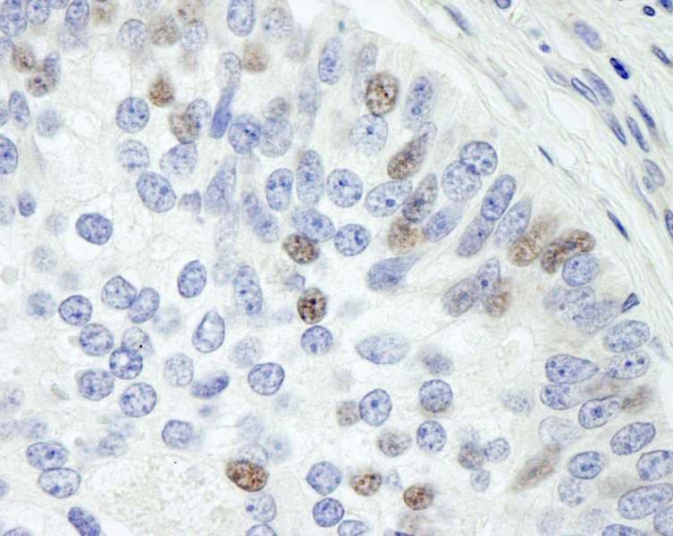 Polyclonal Rabbit anti-Human MAPKAP1 / MIP1 Antibody (aa470-C-term, IHC)