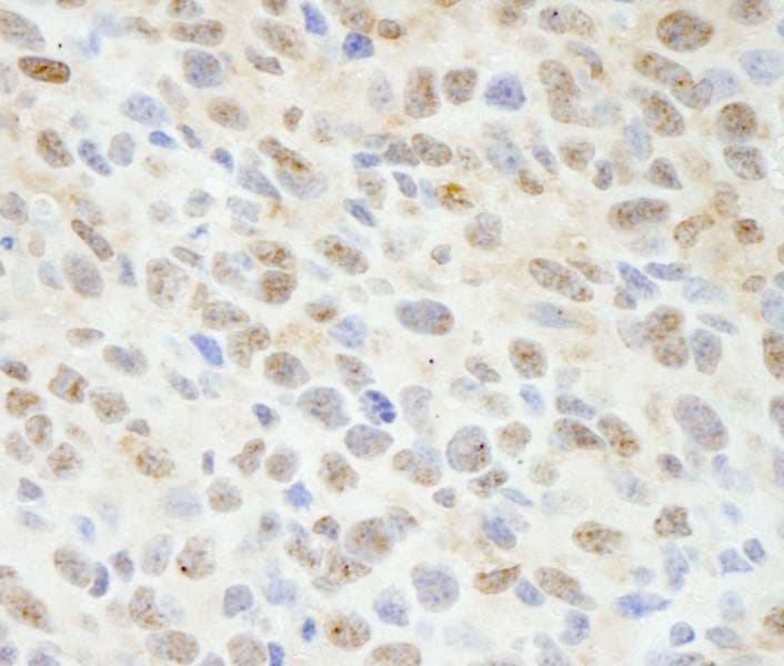 Polyclonal Rabbit anti-Human MAPKAP1 / MIP1 Antibody (aa470-C-term, IHC)