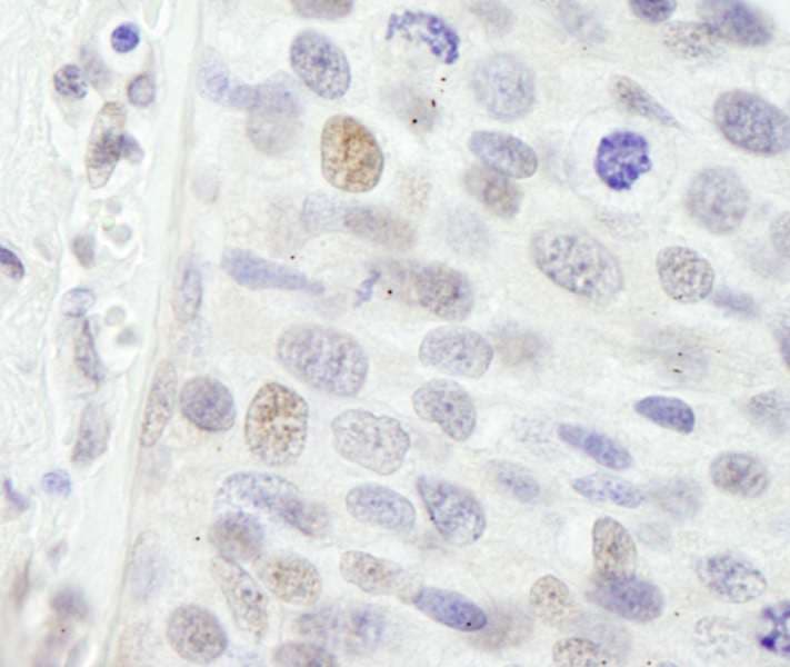 Polyclonal Rabbit anti-Human NBN / Nibrin Antibody (aa704-754, IHC, IF)