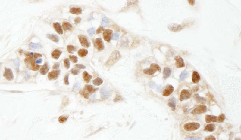 PARP1 Antibody (aa50-100)