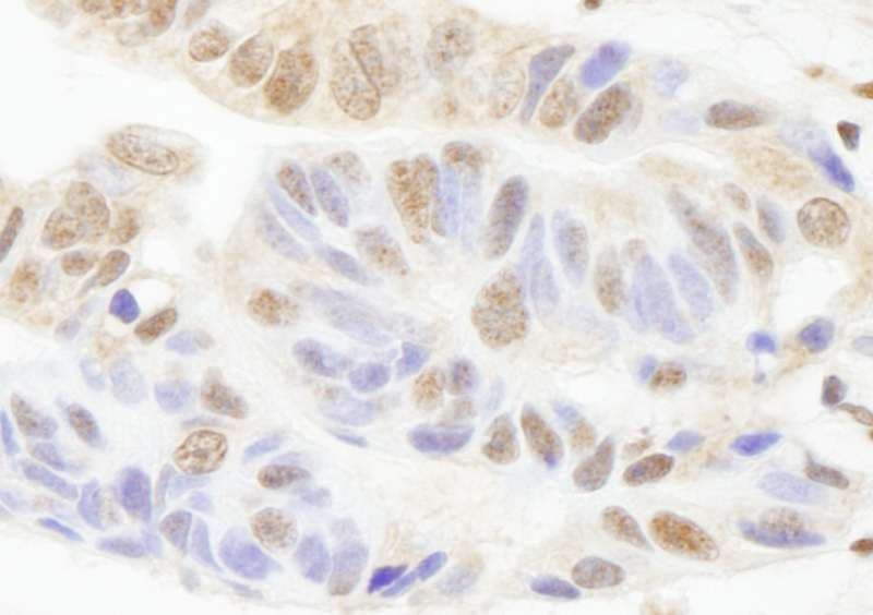 PARP1 Antibody (aa50-100)