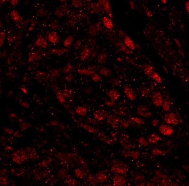 PARP1 Antibody (aa50-100)