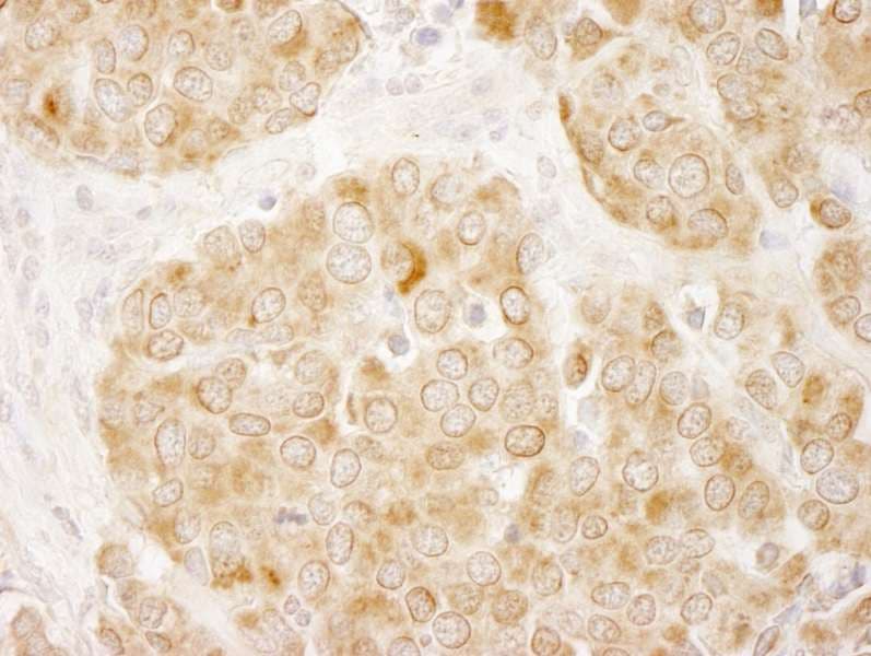 IRS1 Antibody (aa1192-1242)