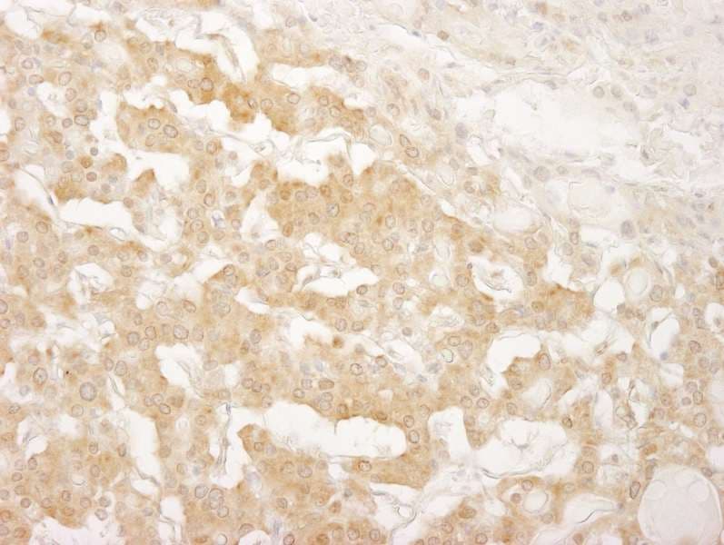 IRS1 Antibody (aa1192-1242)