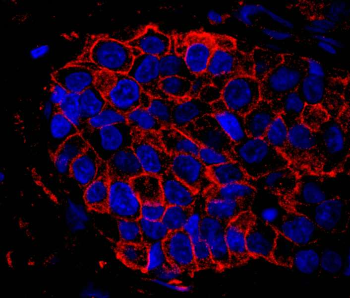 Polyclonal Rabbit anti-Human IQGAP1 Antibody (aa1-50, IHC, IF)