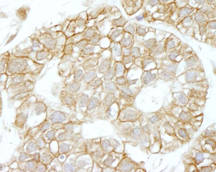 Polyclonal Rabbit anti-Human IQGAP1 Antibody (aa1-50, IHC, IF)