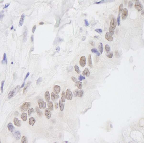 C11orf30 / EMSY Antibody (aa1250-C-term)
