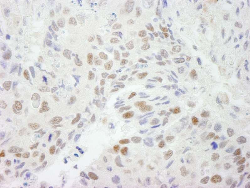HDAC3 Antibody (aa375-C-term)