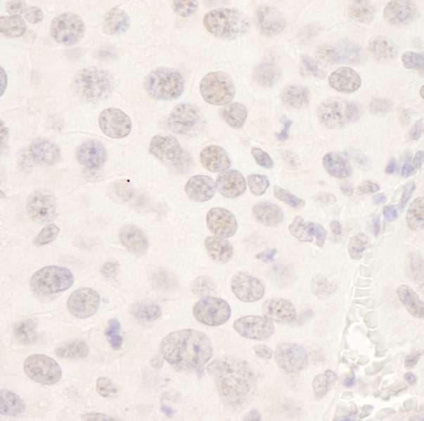 HDAC3 Antibody (aa375-C-term)