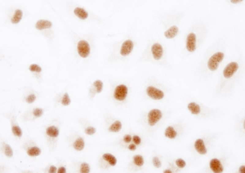 HIF1A / HIF1 Alpha Antibody (aa775-C-term)