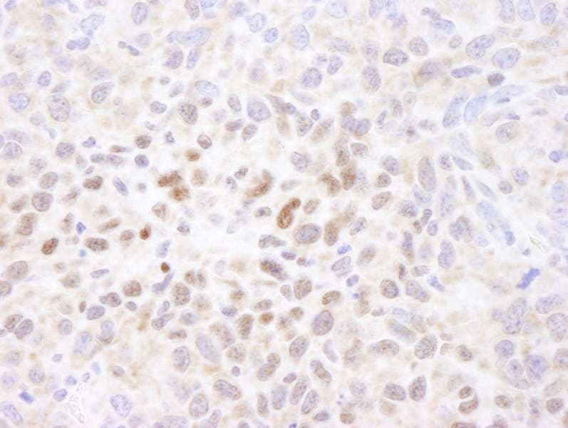 HIF1A / HIF1 Alpha Antibody (aa775-C-term)