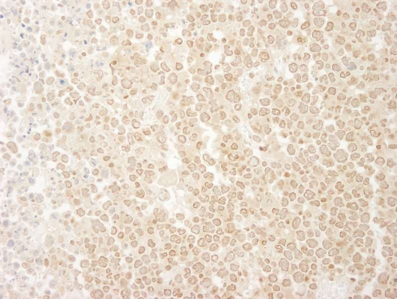 Polyclonal Rabbit anti-Mouse KIF2C / MCAK Antibody (aa50-100, IHC)