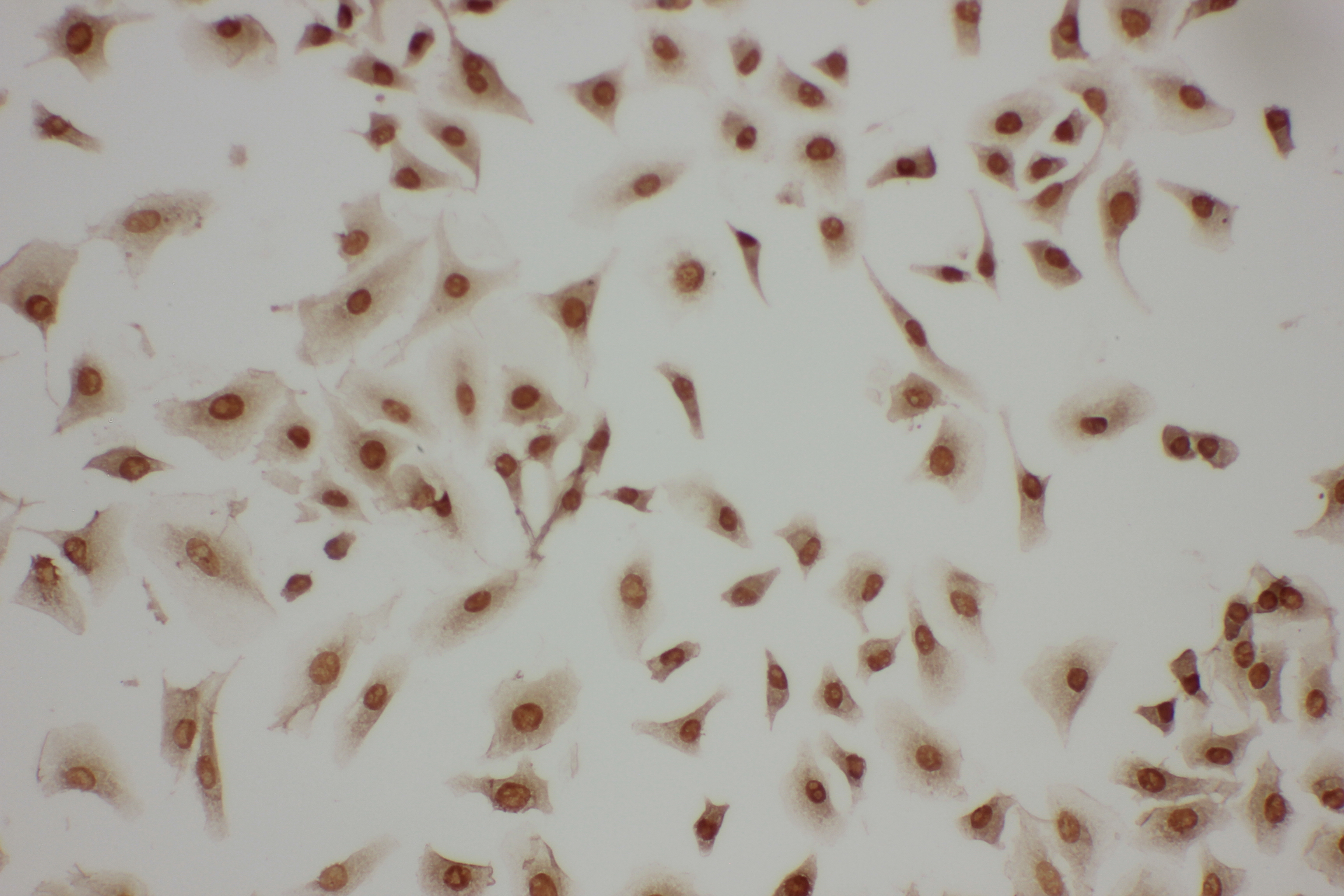 LASP1 Antibody (aa16-30)