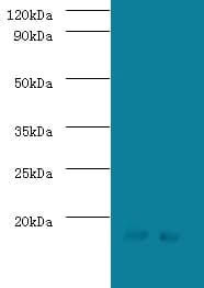 Polyclonal Rabbit anti-Human SRP19 Antibody (Biotin, WB)