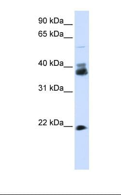 Polyclonal Rabbit anti-Human SYP / Synaptophysin Antibody (N-Terminus, WB)
