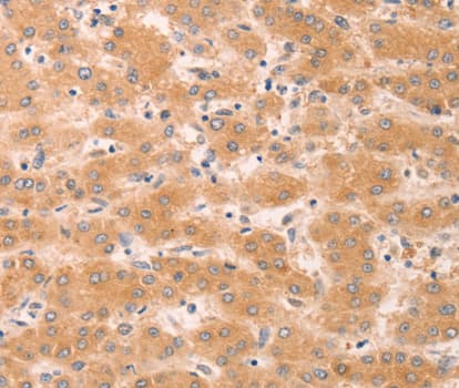 GNA11 Antibody