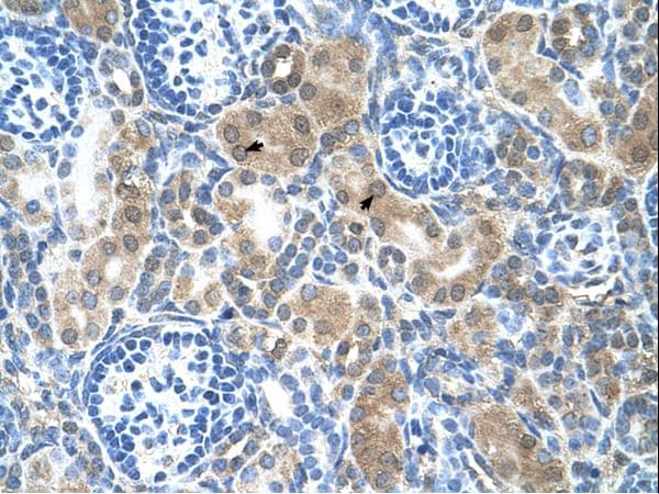 Polyclonal Rabbit anti-Human CBS Antibody (aa164-213, IHC, WB)