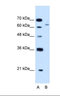 Polyclonal Rabbit anti-Human CBS Antibody (aa164-213, IHC, WB)