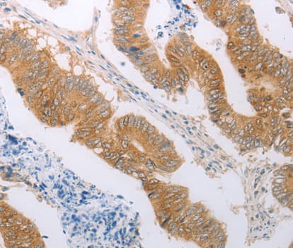 PDK4 Antibody