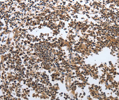 MSH6 Antibody