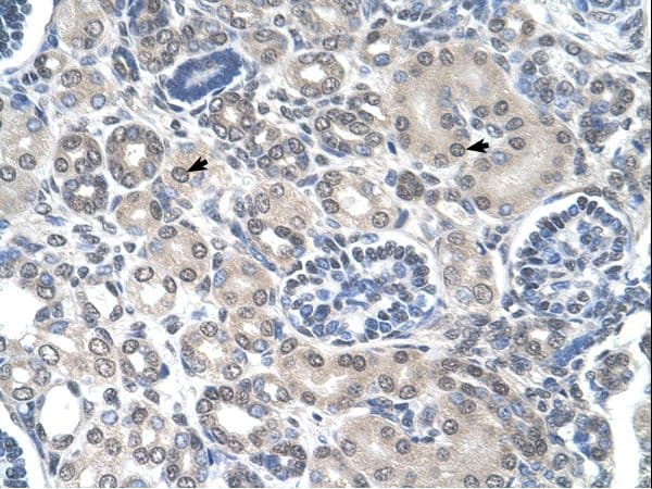 Polyclonal Rabbit anti-Human PPAT Antibody (aa51-100, IHC, WB)