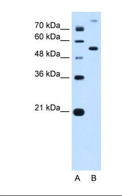 Polyclonal Rabbit anti-Human PPAT Antibody (aa51-100, IHC, WB)