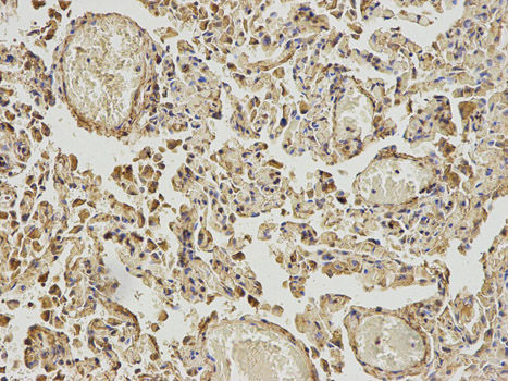 IHC-plus™ ABAT Antibody