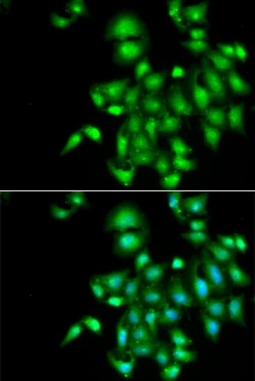 IL20 Antibody