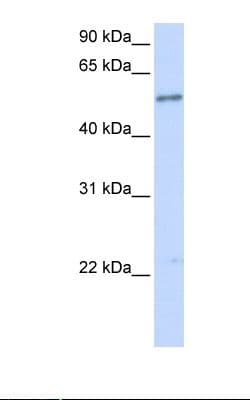 Polyclonal Rabbit anti-Human IL1RL1 Antibody (aa38-87, WB)