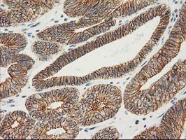 CTNNB1 / Beta Catenin Antibody (clone OTI1B11)
