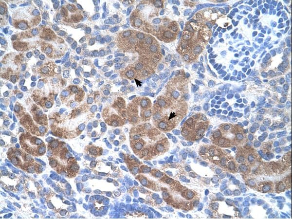 Polyclonal Rabbit anti-Human CD36 Antibody (N-Terminus, IHC, WB)