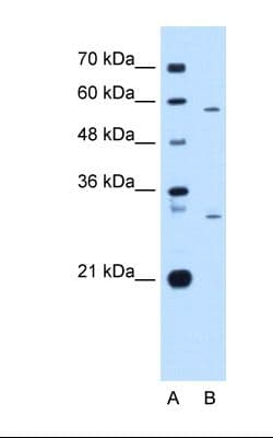 Polyclonal Rabbit anti-Human CD36 Antibody (N-Terminus, IHC, WB)
