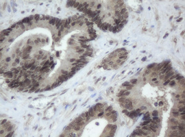 Monoclonal Mouse anti-Human CBX8 Antibody (clone OTI4H3, aa1-260, IHC, WB)