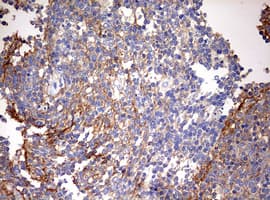 Monoclonal Mouse anti-Human B2M / Beta 2 Microglobulin Antibody (clone OTI1A9, Carrier-free, IHC, WB)