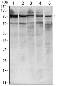 STAT6 Antibody (clone 7D3)