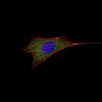 BCL2 / Bcl-2 Antibody (clone 8E+12)