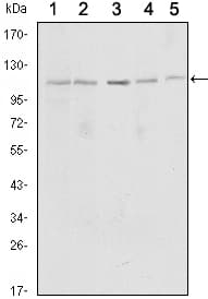 SIRT1 / Sirtuin 1 Antibody (clone 1F3)