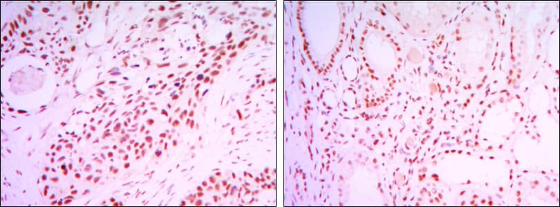 SIRT1 / Sirtuin 1 Antibody (clone 1F3)